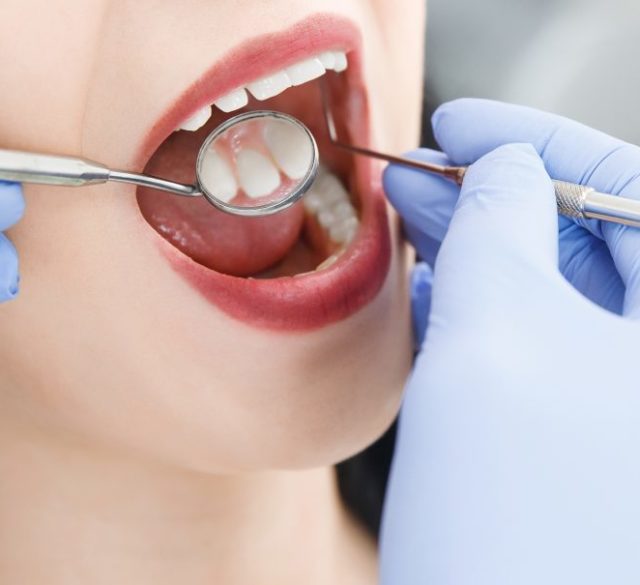 Dentist in Mohali