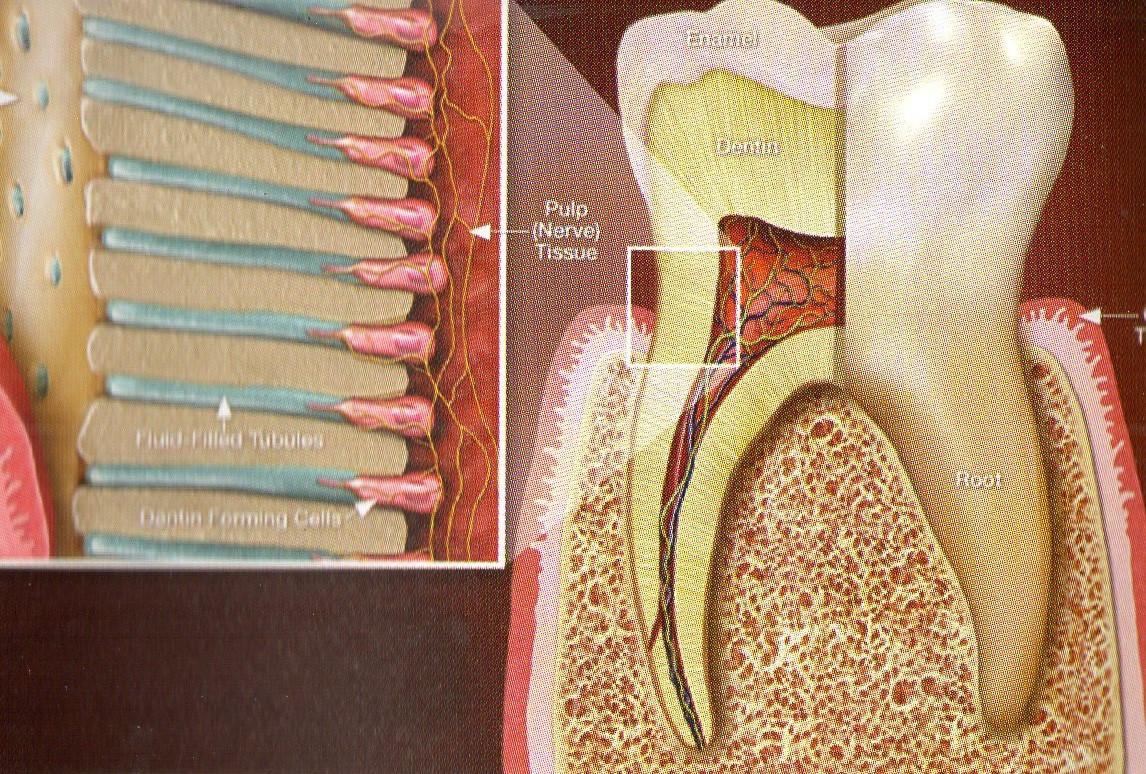 Tooth Sensitivity Deep Dental Clinic And OPG Centre