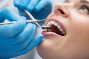 Dentist in Mohali