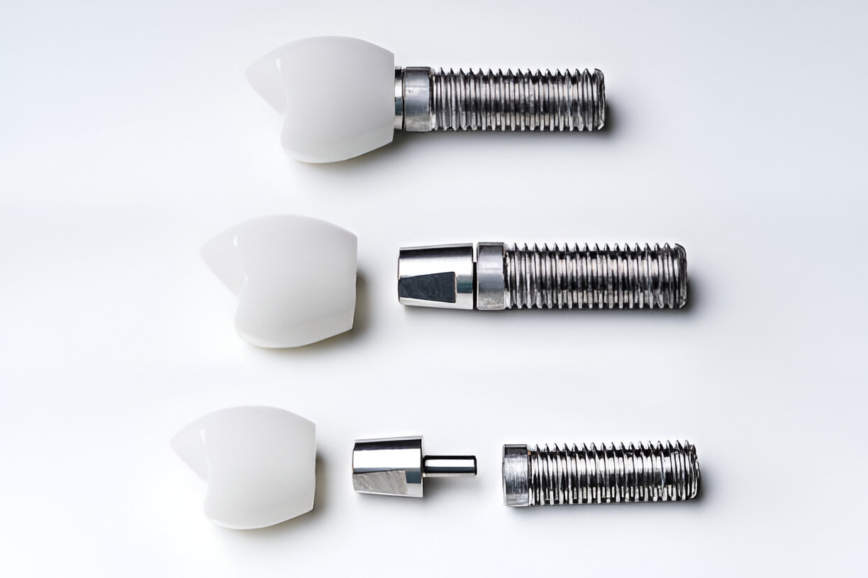 Zimmer Dental Implants in Mohali